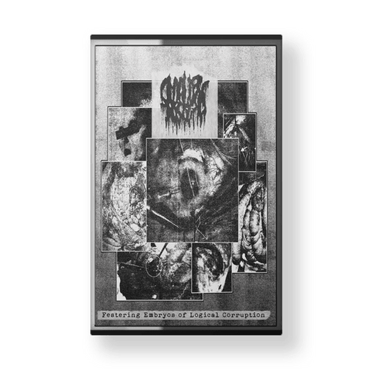 SMALLPOX AROMA "Festering Embryos of Logical Corruption" CASSETTE ( White )